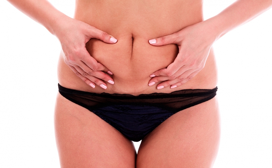 Fazer abdominoplastia acima do peso: com quantos quilos preciso estar?