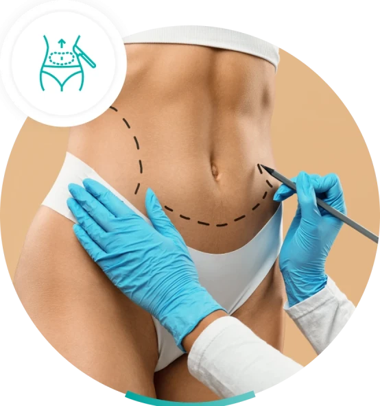 lipoaspiração em Ribeirão Preto