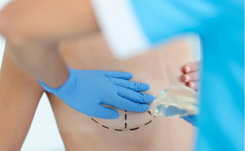 Como é o pós-operatório da mamoplastia redutora?