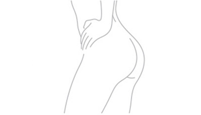 Gluteoplastia (Prótese de Glúteo)