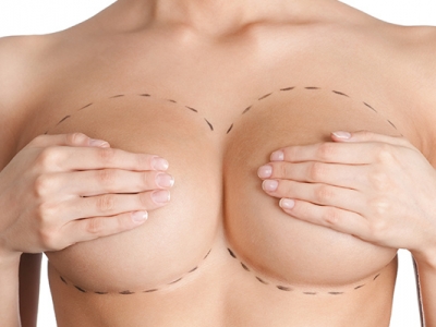 Cirurgia de redução de mama: pontos importantes sobre o procedimento