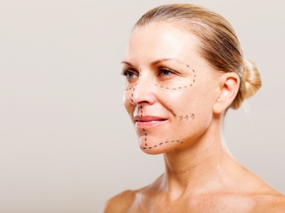 Ritidoplastia ou lifting facial: como funciona essa técnica?