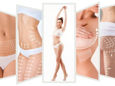 Áreas comuns para lipoaspiração: onde o procedimento é mais eficaz?