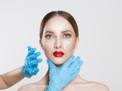 Preenchimento facial com MD Codes: o que é e como ajuda no rejuvenescimento