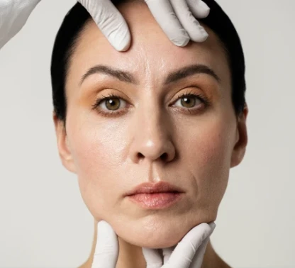 Preenchimento facial MD Codes