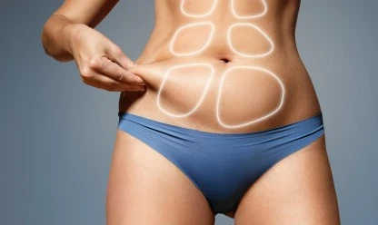 Lipo HD: O que é, diferenças para a lipoaspiração comum e quem pode fazer