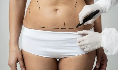 Você está pronta para fazer uma cirurgia plástica? Checklist com aspectos importantes p...