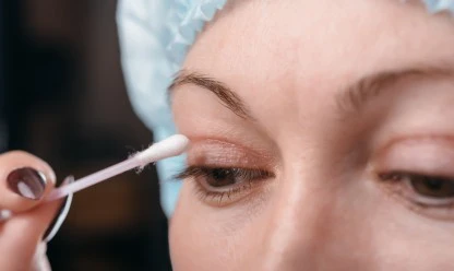 Blefaroplastia Superior: para que serve e como é a recuperação?