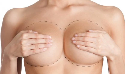 Cirurgia de redução de mama: pontos importantes sobre o procedimento