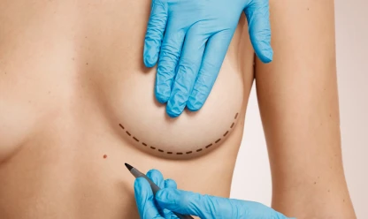 Mamoplastia de aumento ou mamoplastia redutora: descubra qual é a melhor para você
