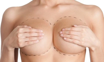 Mamoplastia de redução: quando a cirurgia é indicada?