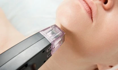 Lipoaspiração facial: o que é, como é realizada e quem pode fazer?