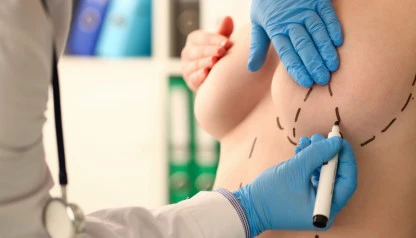 Colocação de prótese de mama com recuperação rápida de 24 horas