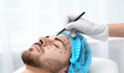 Ritidoplastia: quem pode fazer, qual o preço e como é o pós-operatório?