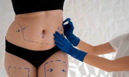 Cirurgia reconstrutiva: como restaurar a forma após uma perda de peso significativa