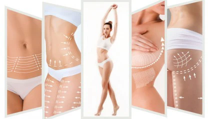 Áreas comuns para lipoaspiração: onde o procedimento é mais eficaz?