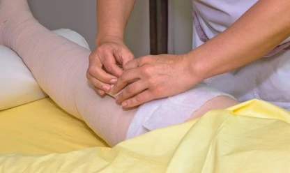 Lipedema: seus tratamentos dentro da cirurgia plástica e nutrologia