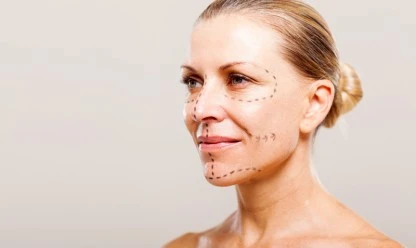 Ritidoplastia ou lifting facial: como funciona essa técnica?