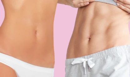 Qual a diferença entre Lipoaspiração HD e Lipoaspiração Tradicional