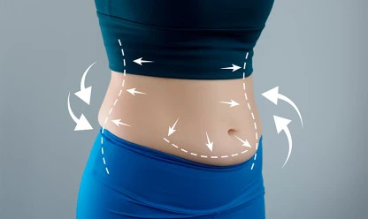 Quem pode fazer lipo lad?