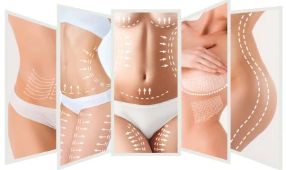 Lipoaspiração com o uso do Renuvion