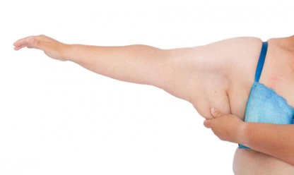 Cirurgia Plástica Pós Emagrecimento: Qual o melhor momento?