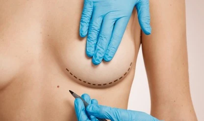 Recuperação pós-mamoplastia de aumento: Guia completo para uma transição suave